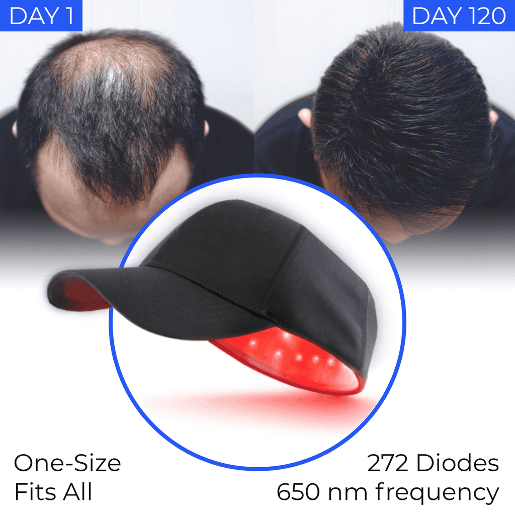Hair regrowth deals cap